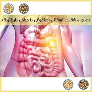 درمان مشکلات استخوانی با جراحی چاقی