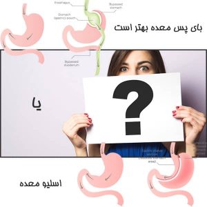 بای پس معده بهتر است یا اسلیو معده