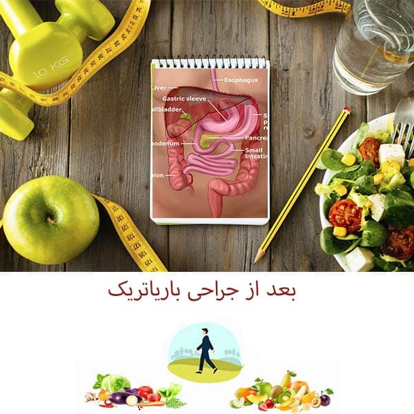 بعد از جراحی باریاتریک
