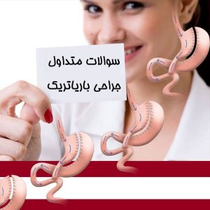 سوالات متداول جراحی باریاتریک