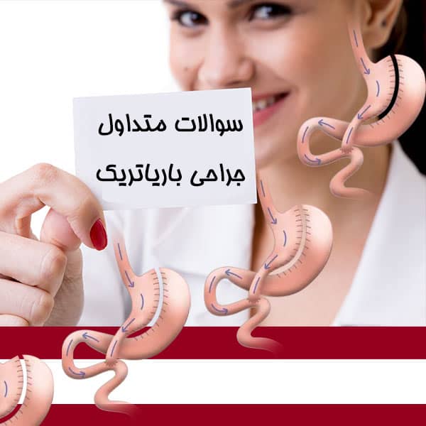 سوالات متداول جراحی باریاتریک