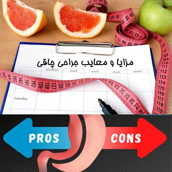 مزایا و معایب جراحی چاقی