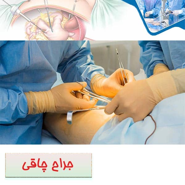 جراح چاقی