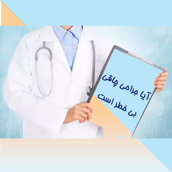 آیا جراحی چاقی بی خطر است