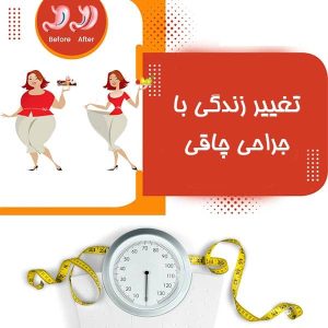 تغییر زندگی با جراحی چاقی
