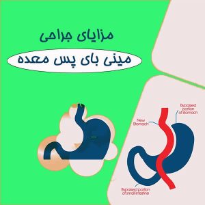 مزایای جراحی مینی بای پس معده