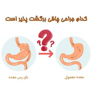 کدام جراحی چاقی برگشت پذیر است