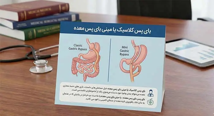 تفاوت بای پس معده و مینی بای پس 5