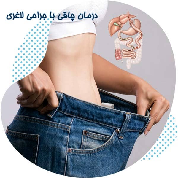 درمان چاقی با جراحی لاغری