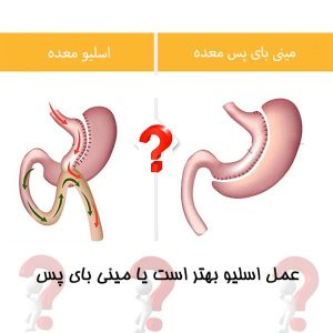 عمل اسلیو بهتر است یا مینی بای پس
