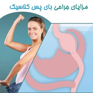 مزایای جراحی بای پس کلاسیک