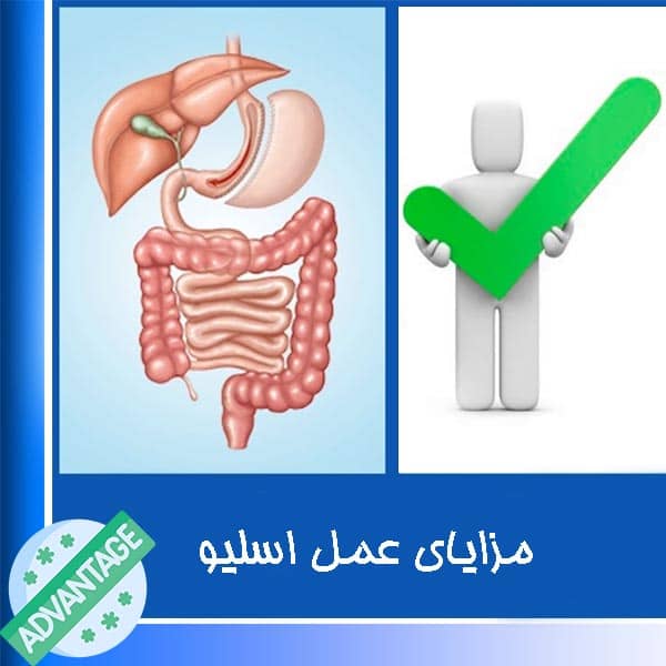 مزایای عمل اسلیو