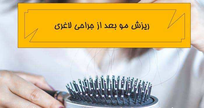 چرا جراحی لاغری 4