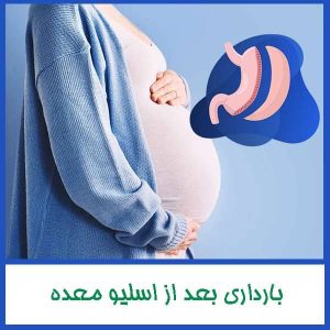 بارداری بعد از اسلیو معده