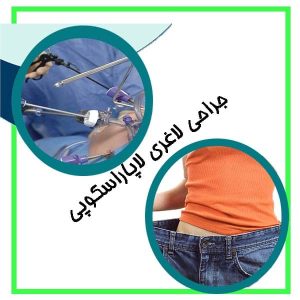 جراحی لاغری لاپاراسکوپی