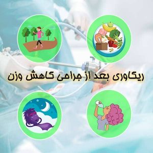 ریکاوری بعد از جراحی کاهش وزن