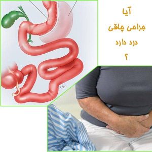 آیا جراحی چاقی درد دارد