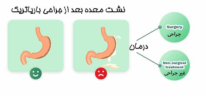 آیا جراحی چاقی درد دارد 4