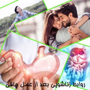 روابط زناشویی بعد از عمل چاقی