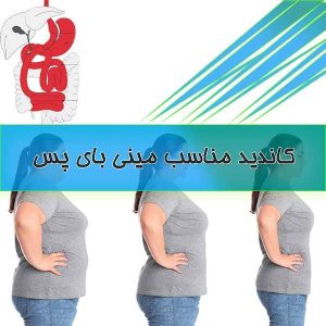 کاندید مناسب مینی بای پس