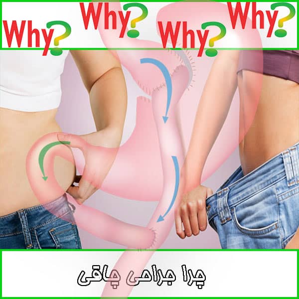 چرا جراحی چاقی