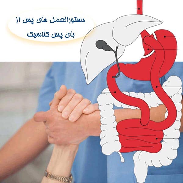 دستورالعمل های پس از بای پس کلاسیک