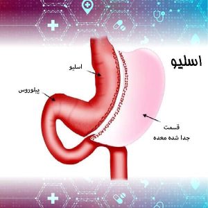 اسلیو