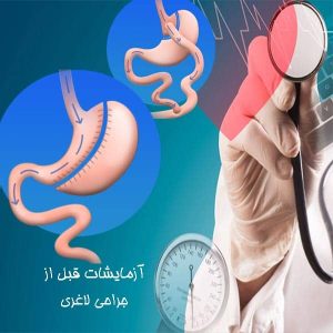 آزمایشات قبل از جراحی لاغری