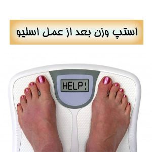 استپ وزن بعد از عمل اسلیو