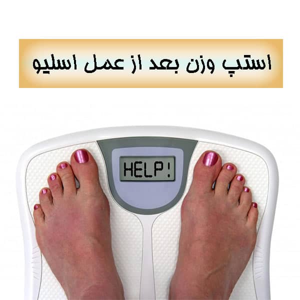 استپ وزن بعد از عمل اسلیو