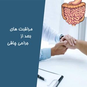 مراقبت های بعد از جراحی چاقی