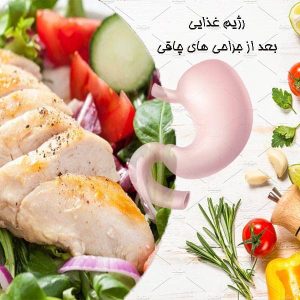 رژیم غذایی بعد از جراحی های چاقی