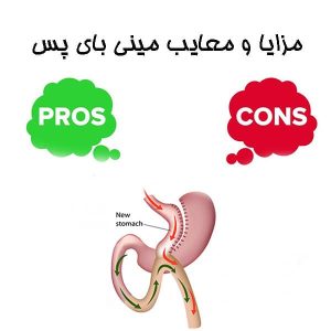 مزایا و معایب مینی بای پس