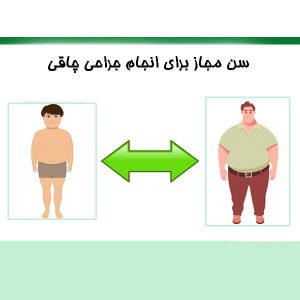 سن مجاز برای انجام جراحی چاقی
