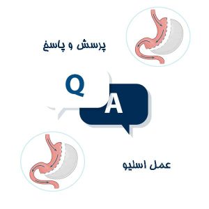 پرسش و پاسخ عمل اسلیو