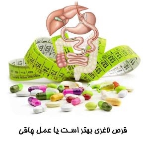 قرص لاغری بهتر است یا عمل چاقی