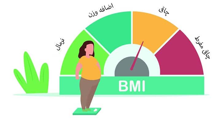 مراحل قبل از اسلیو معده 2