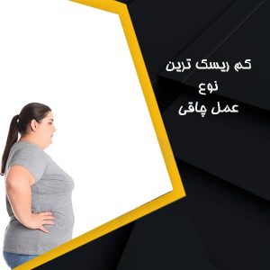 کم ریسک ترین نوع عمل چاقی