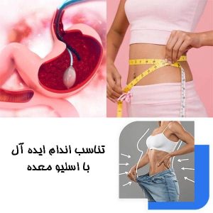 تناسب اندام ایده‌ آل با اسلیو معده