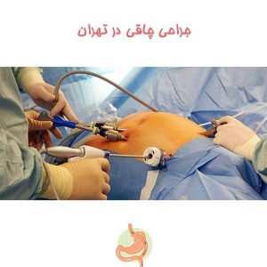جراحی چاقی در تهران