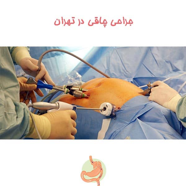 جراحی چاقی در تهران