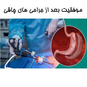 موفقیت بعد از جراحی های چاقی