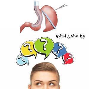 چرا جراحی اسلیو