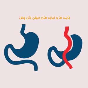 باید ها و نباید های مینی بای پس