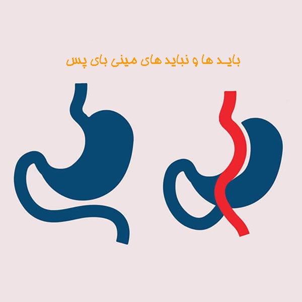 باید ها و نباید های مینی بای پس