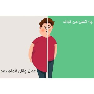 چه کسی می ‌تواند عمل‌ چاقی انجام دهد