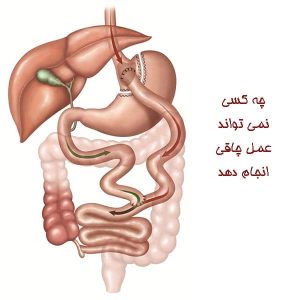 چه کسی نمی تواند عمل چاقی انجام دهد 