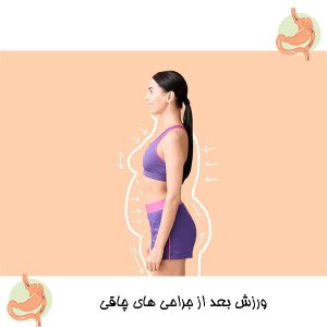 ورزش بعد از جراحی های چاقی