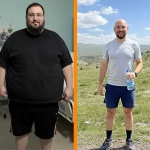 اسلیو معده 40