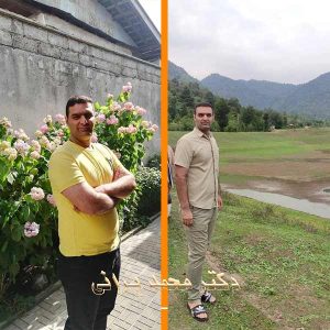 اسلیو معده 48
